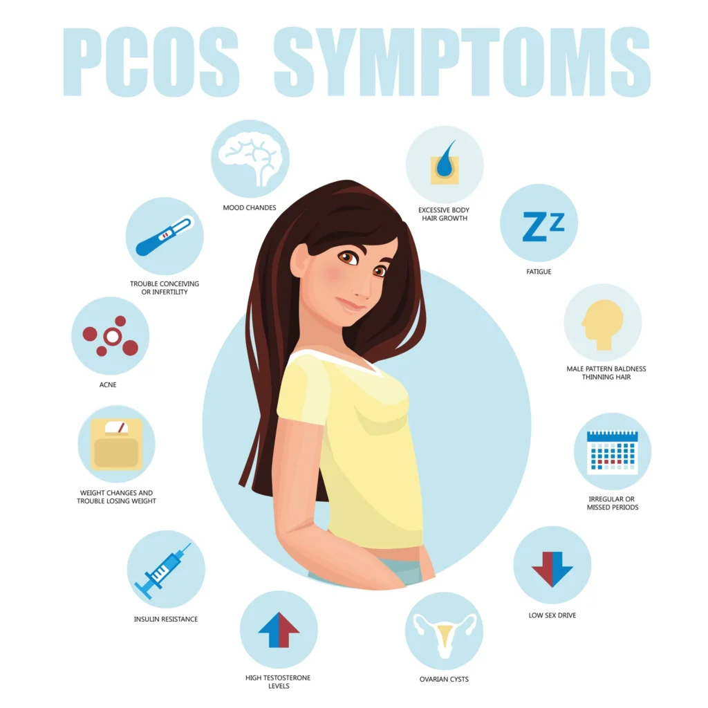 PCOS symptoms illustration